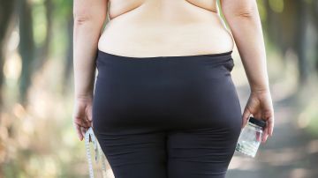 sobrepeso obesidad