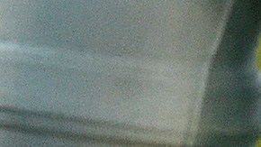 Andy Dalton conmoción