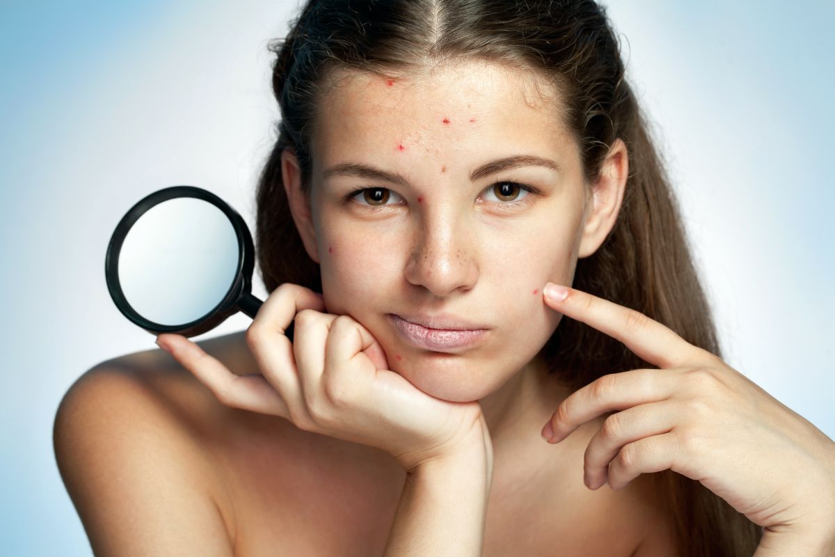Los mejores geles faciales para la limpieza de un rostro grasoso o con tendencia acneica