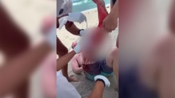 La víctima fue socorrido por otros bañistas y rescatistas de Miami Beach.