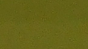 santiago arias lesion