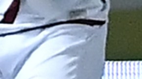 santiago arias fractura