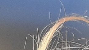 El país concentra el 20% de los casos a nivel mundial.