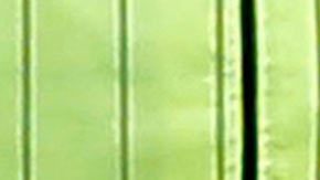 Maradona-hospitalizado