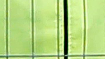 Maradona-hospitalizado