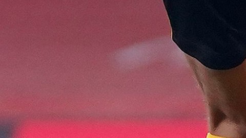 Raul jimenez golpe cabeza