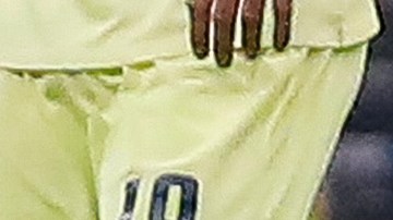 briseño dos santos lesión pelaez