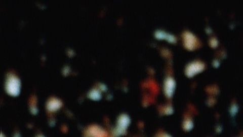 El equipo inglés campeón de 1966 ahora es aquejado por una terrible enfermedad.