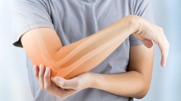 Por qué las mujeres tienen el doble de riesgo de osteoporosis que los hombres