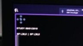 Nuestro cerebro está configurado para sobrevivir a las situaciones extremas.