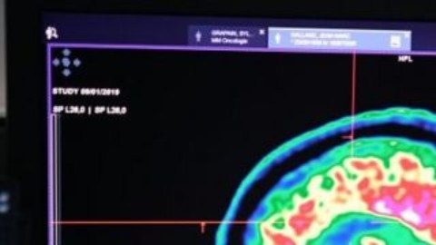 Nuestro cerebro está configurado para sobrevivir a las situaciones extremas.