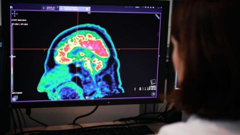 Nuestro cerebro está configurado para sobrevivir a las situaciones extremas.