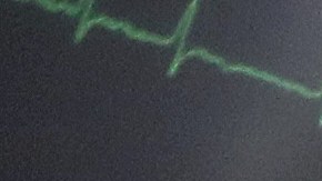 Las autoridades estiman que los hospitalizados alcancen y superen los 5,000 muy pronto.