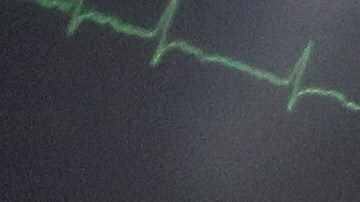 Las autoridades estiman que los hospitalizados alcancen y superen los 5,000 muy pronto.