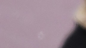 La aparatosa lesión de Joe Burrow.