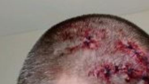 Las heridas del empleado y el sospechoso (der.).