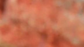 En 2019 se detectaron un total de 202.185 nuevos casos de la enfermedad en 120 países del mundo.