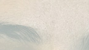 La mayor parte de las personas con asma crónico usan inhaladores.