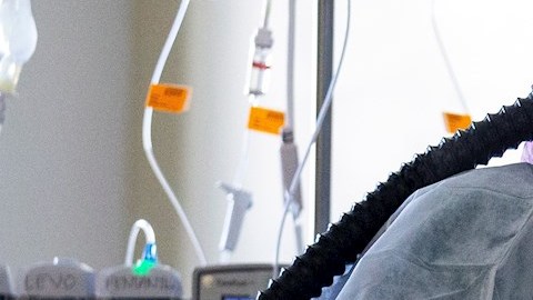 Médicos investigan lo que podría tratarse del primer caso de muerte por COVID-19 a través de un transplante.