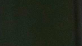 La cirugía en la pierna de Tiger Woods fue larga y compleja. Foto de archivo.