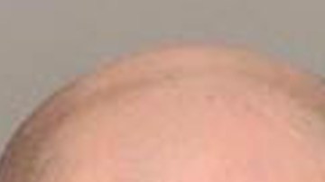 El padre biológico del menor y su madrastra enfrentan cargos por abuso infantil.