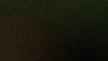 vucetich sin presion