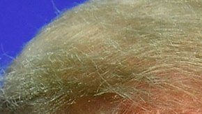 Donald Trump y Anthony Fauci