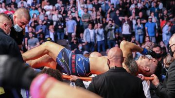 Chris Weidman minutos después de la grotesca fractura de pierna en el UFC 261.