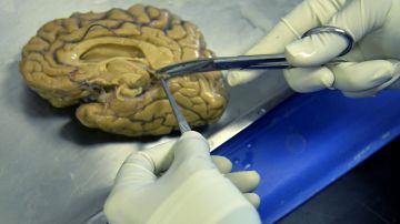 El análisis del cerebro será para determinar si Phillip Adams sufría de CTE.