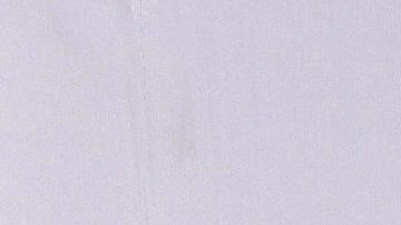 Luz Elena González presume su retaguardia mientras recibe un masaje reafirmante