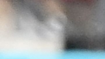 Sufrió la lesión cuando disputaba el segundo partido de Francia en la Euro contra Hungría.