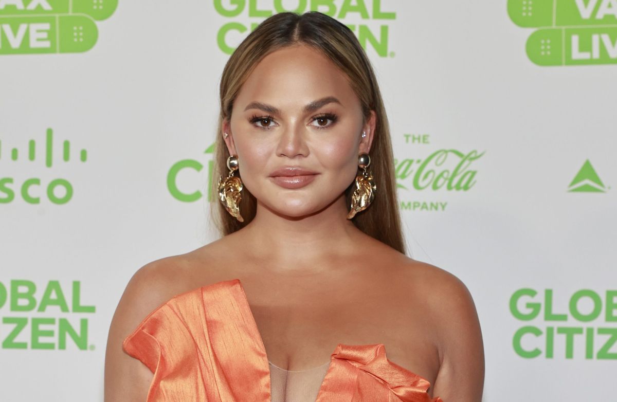 Chrissy Teigen underwent surgery to remove fat from her cheeks, and shows the results