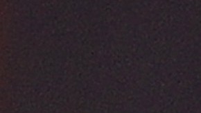 El irlandés estará fuera de acción por lo que resta del año.