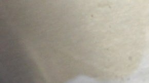 Niño muere a causa de una ameba come cerebros que contrajo en un parque en Texas