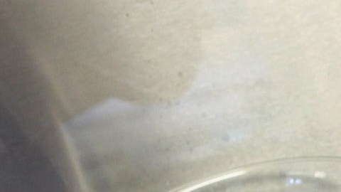 Niño muere a causa de una ameba come cerebros que contrajo en un parque en Texas