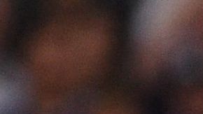 El jugador se fracturó la pierna izquierda tras ser embestido por unfutbolista del Leeds United.