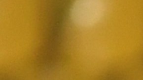 Arthur está en la etapa final de su proceso de recuperación, luego de operarse por un problema de calcificación.