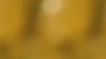 Arthur está en la etapa final de su proceso de recuperación, luego de operarse por un problema de calcificación.