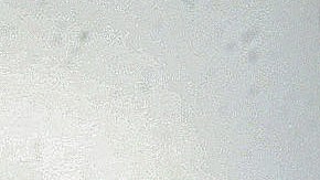 TORRANCE, CALIFORNIA - JANUARY 21: (EDITORIAL USE ONLY) Clinicians care for COVID-19 patients in a makeshift ICU (Intensive Care Unit) at Harbor-UCLA Medical Center on January 21, 2021 in Torrance, California. The hospital is over its ICU capacity due to the coronavirus and has been forced to treat multiple COVID-19 patients who require ICU level care together in converted rooms which were designed for lower levels of care. California has become the first state in the nation to record 3 million known COVID-19 infections. Los Angeles County reported more than 250 COVID-19 fatalities on January 21. (Photo by Mario Tama/Getty Images)