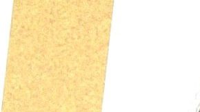 VIDEO: Andrea Meza aparece con marcas de violencia en su cuello y alarma a sus fans