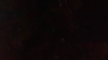 ATLANTA, GA - OCTOBER 15: Ebola patient Amber Vinson arrives by ambulance at Emory University Hospital on October 15, 2014 in Atlanta, Georgia. Nurse Amber Vinson joins Nina Pham as health workers who have contracted the Ebola virus at Texas Heath Presbyterian Hospital while treating patient Thomas Eric Duncan, who has since died. (Photo by Kevin C. Cox/Getty Images)