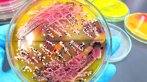 Detectan personas contagiadas por brote de salmonela en 25 estados