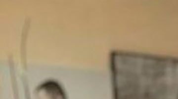 La foto de Instagram de Olivier Rousteing muestra las lesiones que sufrió el año pasado, dijo el diseñador.