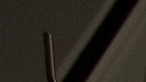 BIRMINGHAM, UNITED KINGDOM - JUNE 09: Consultant Surgeon Andrew Ready and his team conducts] a live donor kidney transplant at The Queen Elizabeth Hospital Birmingham on June 9, 2006, in Birmingham, England. Kidney failure patient Carol Playfair was given the chance of life when her sister Tracey Playfair offered one of her own perfect kidneys to help save the life of Carol. The operation at The QE Hospital, part of The University Hospital's Trust was one of 1500 live donor transplants carried out in the United Kingdon every year. Despite the introduction of Donor Cards, there are still too few kidneys available to help all those who require a transplant, thereby producing a waiting list and the only chance of survival is by live donor. (Photo by Christopher Furlong/Getty Images)