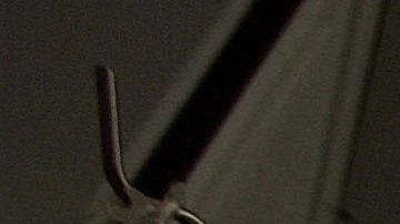 BIRMINGHAM, UNITED KINGDOM - JUNE 09: Consultant Surgeon Andrew Ready and his team conducts] a live donor kidney transplant at The Queen Elizabeth Hospital Birmingham on June 9, 2006, in Birmingham, England. Kidney failure patient Carol Playfair was given the chance of life when her sister Tracey Playfair offered one of her own perfect kidneys to help save the life of Carol. The operation at The QE Hospital, part of The University Hospital's Trust was one of 1500 live donor transplants carried out in the United Kingdon every year. Despite the introduction of Donor Cards, there are still too few kidneys available to help all those who require a transplant, thereby producing a waiting list and the only chance of survival is by live donor. (Photo by Christopher Furlong/Getty Images)