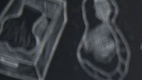 Restaurante de Salt Bae