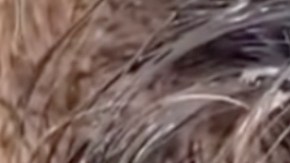 VIDEO: Niña es invadida por cientos de piojos