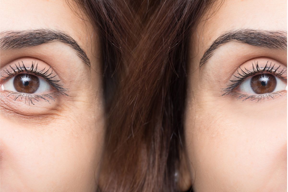 5 productos para evitar ojeras y arrugas bajo los ojos - La Opinión