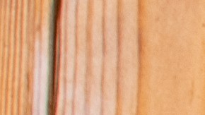 La violencia doméstica no son solo golpes. IShutterstock)