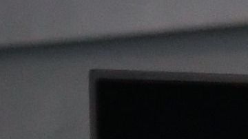 A migrante le detectaron una solitaria que tenía alojada en el cerebro desde hace décadas